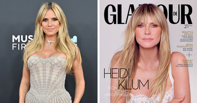 Heidi Klum reveals she suffers from a disorder that she partly credits for her success
