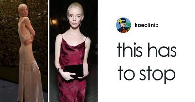 “She Looks Very Unhealthy”: Internet Tore Apart Anya Taylor-Joy’s Pre-Oscars Appearance Amid Ongoing Hollywood Trend
