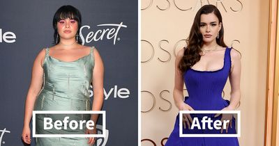 “Everything About Her Is Plastic And Fake”: Fans Brutally Roast 10 Celeb Appearances At The 2026 Oscars