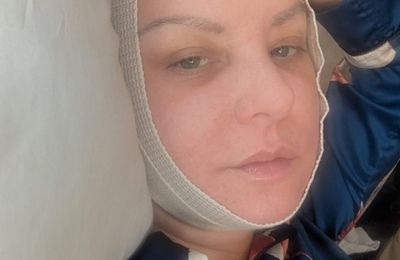 Wendi McLendon-Covey was absent from Bridesmaids Oscars reunion due to plastic surgery recovery