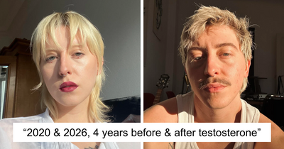 61 Fascinating Then-And-Now Photos That Show How Time Transforms Everything