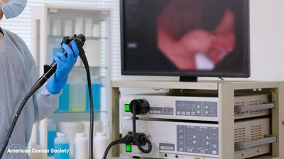 Colorectal cancer is now the most common cause of cancer deaths in the US for people under 50