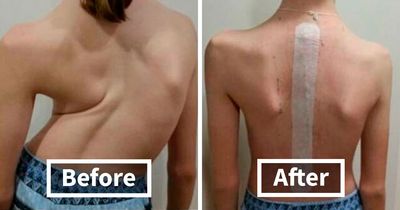 69 Unusual Medical Photos That Land Somewhere In Between Science And Nightmare