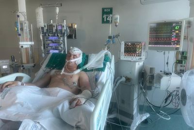 Teenager makes remarkable recovery after horror accident in Ibiza