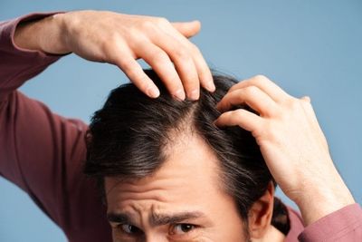 Minoxidil Users Make the Same Errors and Here’s How to Get Better Results