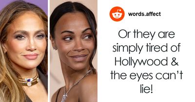 Doctor Reveals Reason Behind “Tired Eyes” That Has Stars Looking Sleepy Despite Youthful Faces