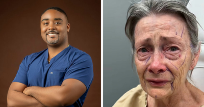 ‘Miracle’ Plastic Surgeon Goes Viral After Transforming Grandma To Look Decades Younger