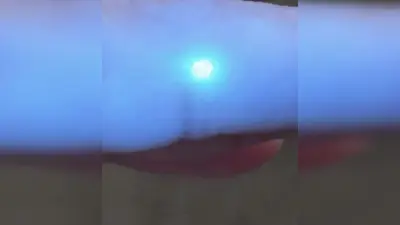 ‘Alien implanted chip’: Man gets alarmed by fiancee’s green glowing finger — the internet may have finally decoded the ‘why’