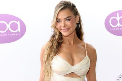 Denise Richards shares unfiltered before-and-after facelift photos in rare Hollywood reveal