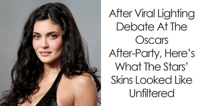 After Viral Lighting Debate At The Oscars After-Party, Here’s What The Stars’ Skins Looked Like Unfiltered