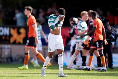 Sloppy Celtic suffer huge title race blow with meek Dundee United defeat