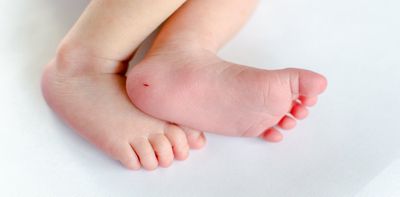 Testing newborns for spinal muscular atrophy – screening programme begins in Scotland