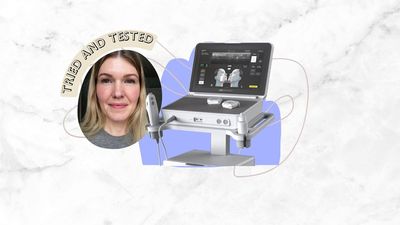 I tried Ultherapy Prime to tighten up my face, needle-free - here are my honest thoughts with photos