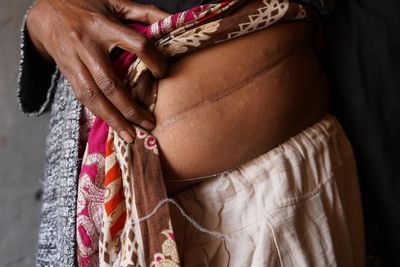 ‘The whole country is doing it’: how illegal kidney traders target Pakistan’s desperate brick kiln workers