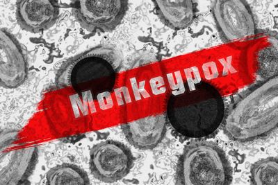 Monkeypox Surge in 2026: Travel Advisory, Symptoms, Vaccination & Prevention Guide