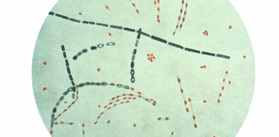 Anthrax-causing bacteria have dwelled in soil for centuries – cycling through people, animals and earth