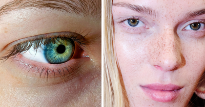 How Rare Are Green Eyes, And What Genetics Says About Their Origins