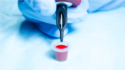 Diagnostic dilemma: A cross tattoo on a man's neck disappeared — killing his skin as it did so