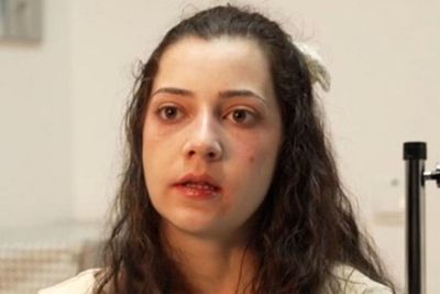 Woman dies after winning legal battle for right to euthanasia