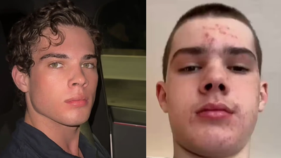 New troubling details surface around Clavicular’s arrest as streamer's school past, extreme looksmaxxing and risky behavior raise concern