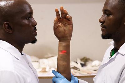 ‘Prosthetics aren’t made for people like us’: the brothers creating innovative artificial limbs for Africans