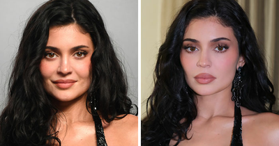 “Just To Edit Them Out?”: Fans Notice Dramatic Differences Between Kylie Jenner’s Personal And Public Photos