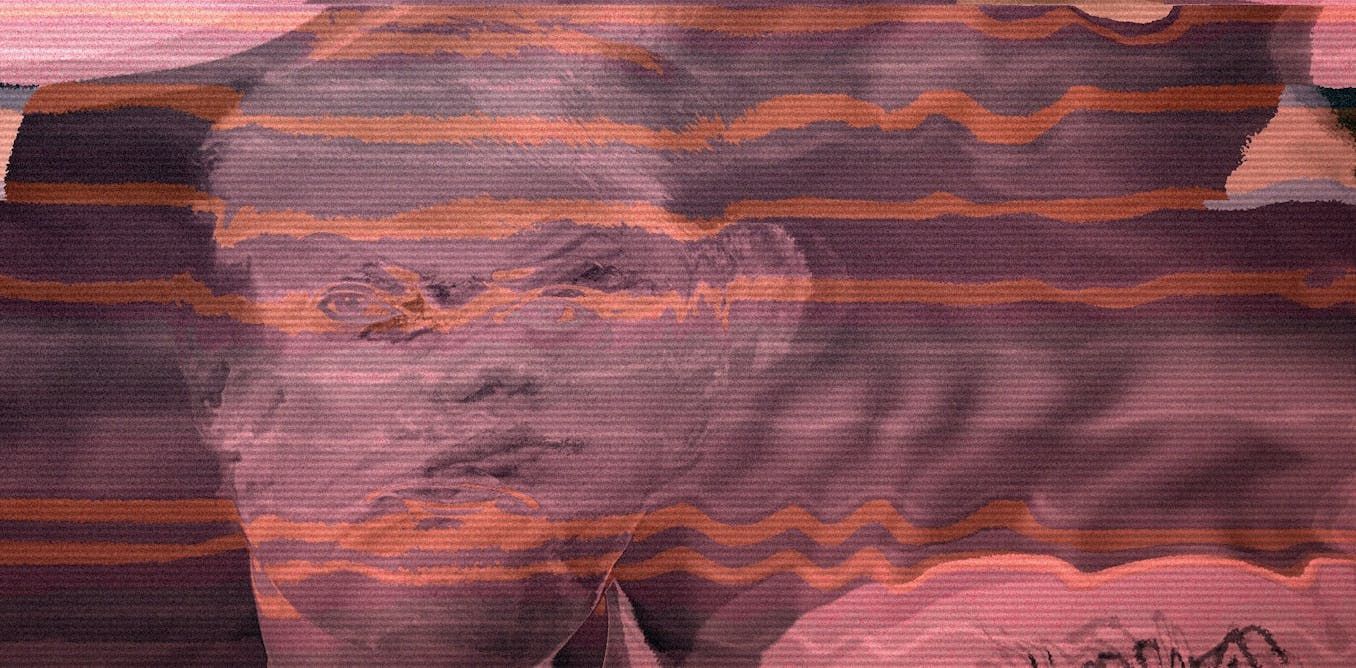 Exploding head syndrome: the surprisingly common…