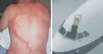 “Should Have Been 100% Fatal”: 49 People Who Survived Against All Odds