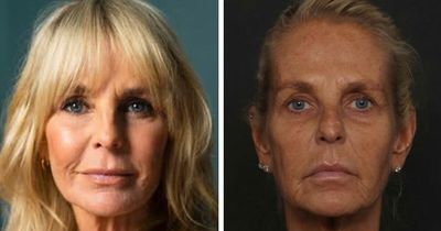 Ulrika Jonsson, 58, Reveals The Six Months Of Treatments Behind Her Dramatic Transformation