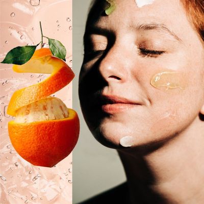 Does Vitamin C Help Acne-Prone Skin? Dermatologists Explain