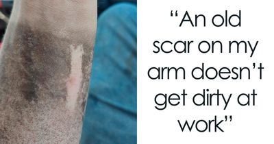 65 Photos Of The Human Body In Shapes And Conditions You Might Not Have Seen Before