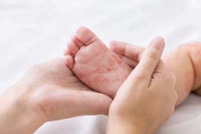 Bangladesh rolls out emergency measles vaccination drive after dozens of child deaths