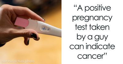 79 Weird And Interesting Medical Facts That Turned Out To Be True