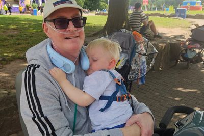 Arm skin patch from organ donor helped patient spot his new lung was being rejected