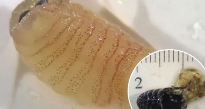 Greek Woman Sneezes Out Rare Sheep Bot Fly Larvae in Baffling Medical Case