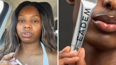 ‘Vaseline ain’t ever did me wrong’: Houston woman uses EADEM lip balm. Then it ‘burns’ off her lips
