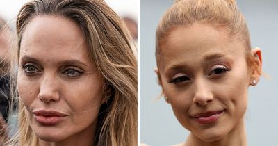 50+ Photos Of Celebrities’ Skins Up Close That Show They’re Human Just Like Us
