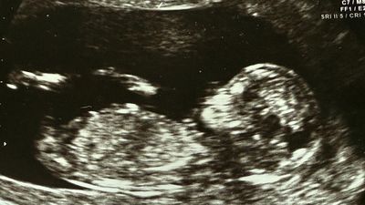 IVF giant again in play after new bid pumps up shares