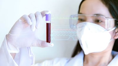 With ALYZE, Pro Athletes Are Taking Their Care Into Their Own Hands