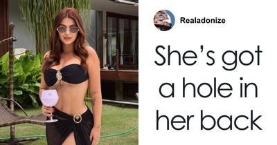 “Puts Things Into Perspective”: Influencer Reveals The Botched Plastic Surgery She Had Been Hiding With Photoshop For Years