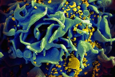 Man ‘cured’ of HIV after brother found to carry rare genetic mutation: ‘Like winning lottery twice’
