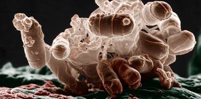 Antibiotics can trigger bacteria to release bubbles of inflammation tinder, making it harder to treat infection