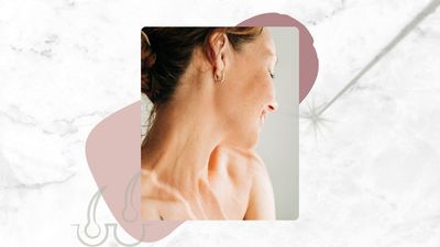 I've just had laser hair removal on my face, but I wish I'd known these 9 things before I started