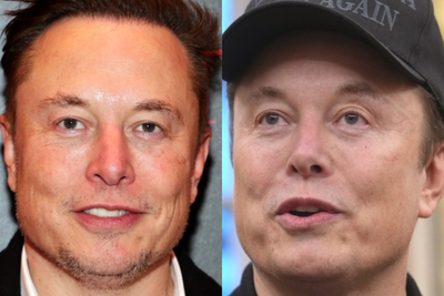 Elon Musk 'Mounjaro' Face Side Effects and Potential $172,000 Plastic Surgery Spark Weight Loss Drug Concerns