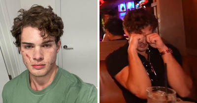 ‘Looksmaxxing’ Influencer Clavicular Breaks Silence After ‘Brutal’ Hospitalization Following Live Incident