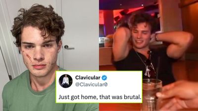 Looksmaxxer Clavicular Reveals Reason For Hospitalisation After Collapsing On Livestream