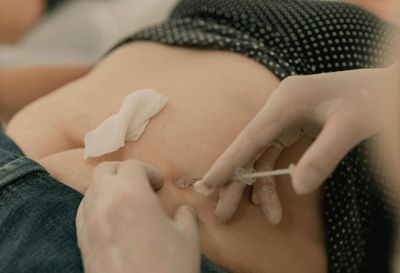 Wegovy Tragedy: Woman in Pain with 'Black Tongue' and Lost Organ After Weight Loss Jabs