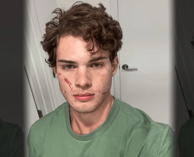 Clavicular's Family 'Very Concerned' After Suspected Overdose During Livestream: Are They Referring to His Friends?