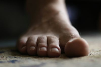 Gout Treatment May Lower Heart Disease and Stroke Risk, New Study Suggests Benefits