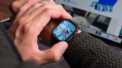 At last! Blood sugar measurements could be coming to your Apple Watch